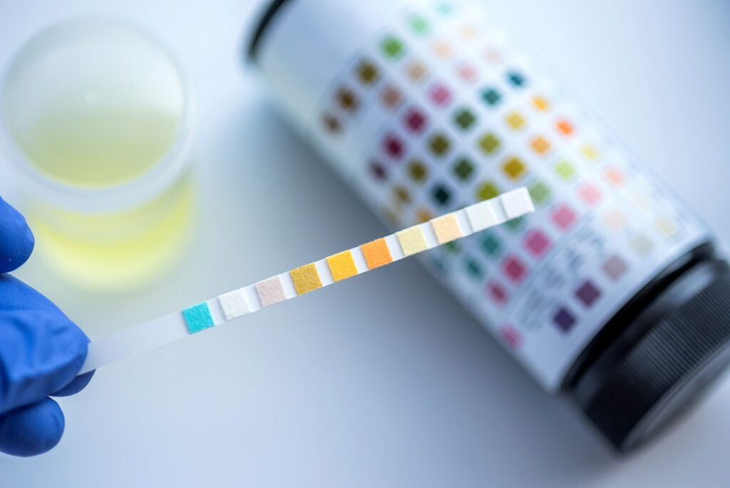 drug and alcohol testing drug testing